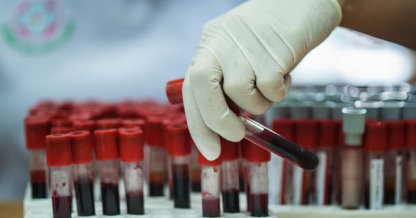 Учени от Амстердамския свободен университет разработиха първия по рода си