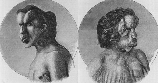 През 1882 г в приют за бедни в Лестър Англия