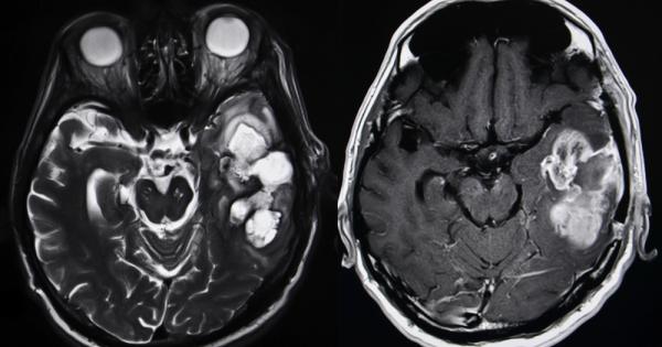 Скорошно проучване проведено от изследователи от университета Нагоя откри че