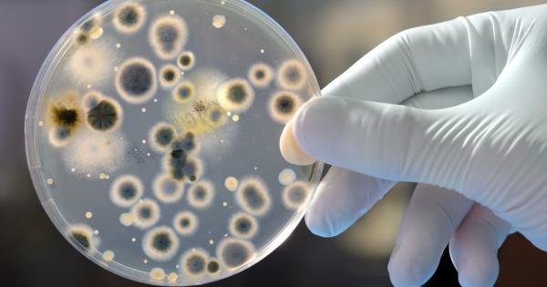 През 2001 ва една пръдлива медицинска сестра задала доста необичаен въпрос