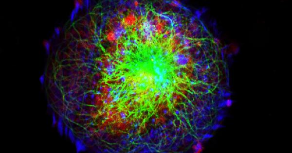 Австраийски учени откриха нов начин за лечението на агресивния рак