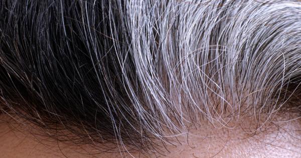 С възрастта косата става сива тъй като произвеждащите цвят стволови