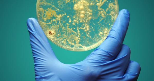 Искате да си отгледате микроби в петриева паничка Елементарно е
