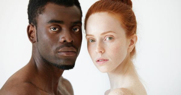 Светлата кожа както и физиологичната способност организмът да преработва кравето