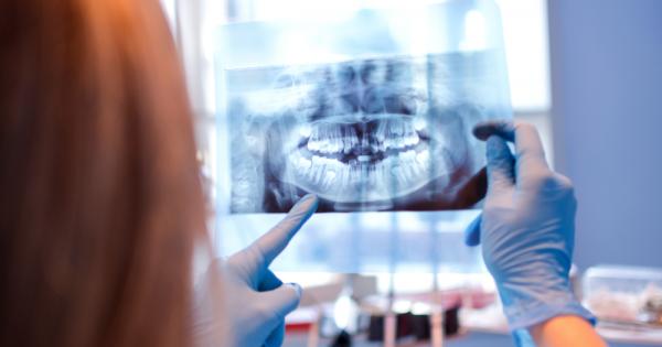 Всички храни и напитки които приемаме оказват съществено влияние върху