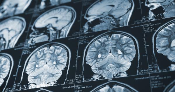 Франция спря временно всички проучвания на прионовите болести провеждани в