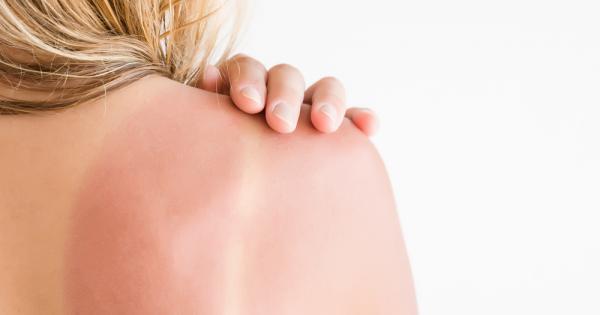 Идва лято и слънцето става все по силно Рядко му обръщаме