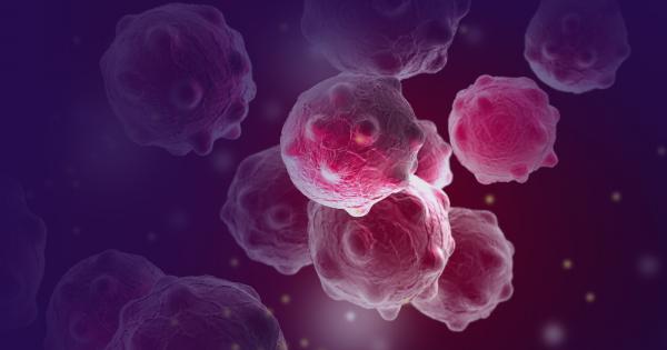 Ракът на гърдата е най разпространеното онкологично заболяване на планетата Той