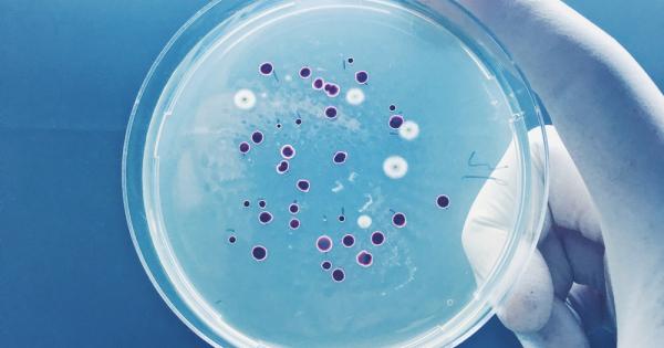 Когато са подложени на стресови условия и вече няма с