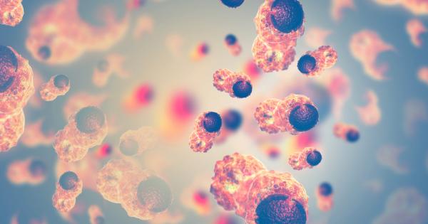 Ракът на черния дроб е един от най трудните за откриване