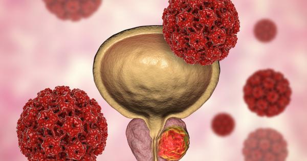 Проф д р Марта Хофман е специалист по ядрена медицина във