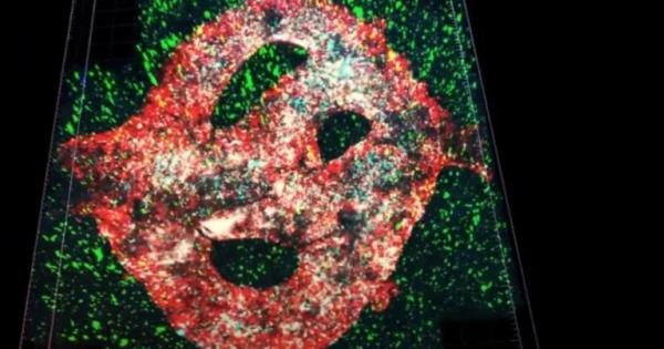 За първи път учени успешно 3D биопринтираха един от най смъртоносните