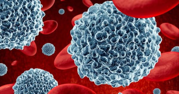 Жена от Флорида диагностицирана с раково заболяване на гърдата в