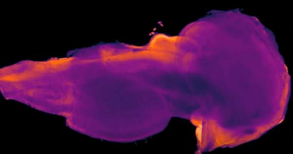 Без съмнение мозъкът е най мистериозният човешки орган Дори и след