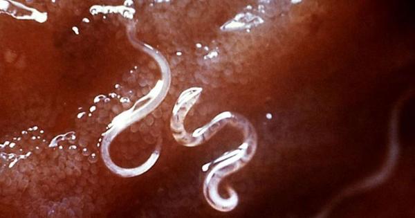 През март 2018 г 68 годишна жена от Небраска САЩ започва