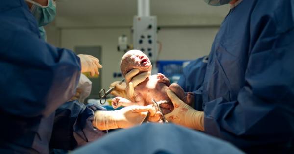 Новаторска техника за оперативно раждане, наречена естествено цезарово сечение“, представи