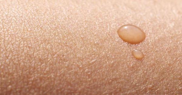 Нашата кожа може и да ни създава проблеми понякога но