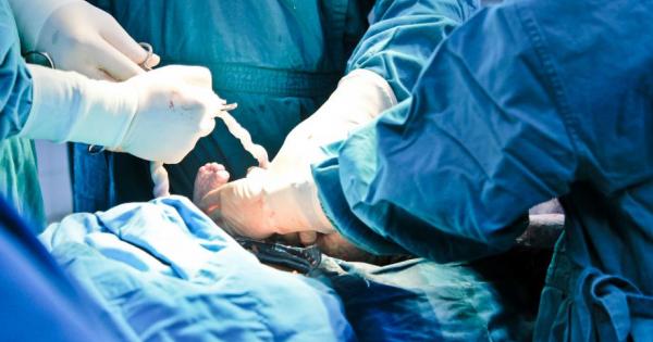 Повечето бъдещи майки днес са раздвоени между естествено раждане и