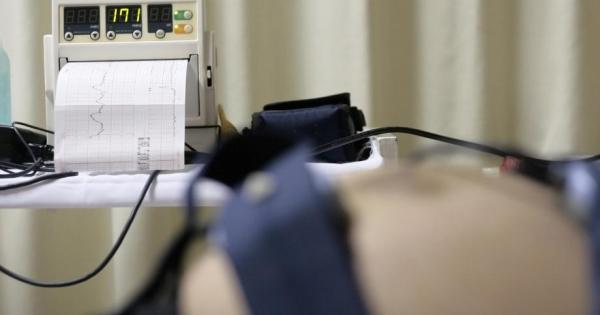 Един от важните параметри който дава информация за хода на