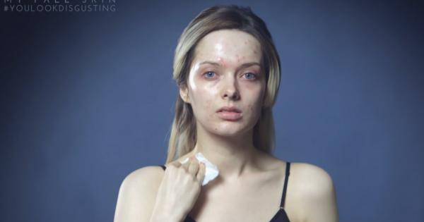 Преди време YouTube влогърът с прякор My Pale Skin започна да публикува свои снимки