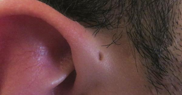 Може би сте забелязали че някои хора имат едва забележима