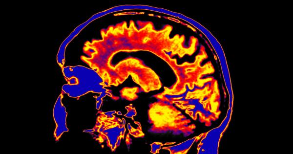 Депресиите са широко разпространени състояния и точно през студените зимни