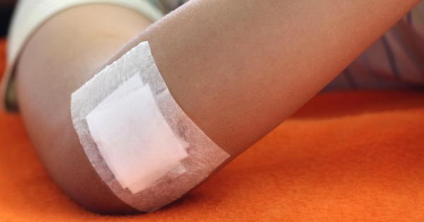 Учени разработиха еластично хирургично лепило което може да промени радикално