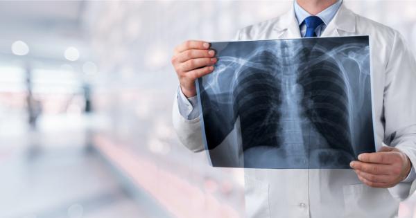 Ако искате да забавите естественото стареене на белите дробове и