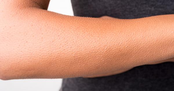 От гледна точка на еволюцията настръхването на кожата е рефлекс