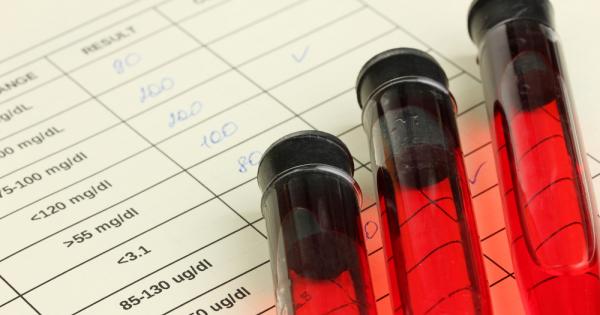 Учени излекуваха вируса на ХИВ който причинява Синдром на придобита