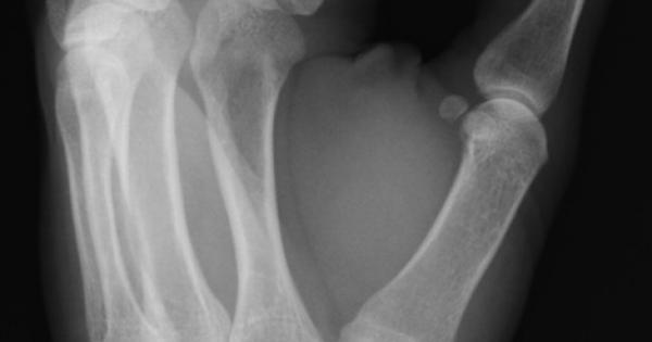 Както повечето велики научни открития и това се е случило