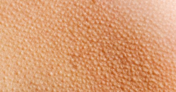 Защо настръхваме когато ни е студено или слушаме страхотна музика