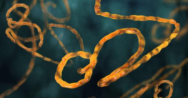 Японска лаборатория внесе ебола както и четири други вирус на