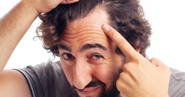 Мъжете чиято коса оредява значително са изложени на по голям риск