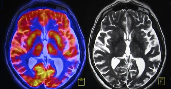 Има купища бабини деветини които са се навъдили покрай популярните