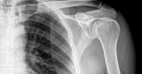 През 50 те години на миналия век в Съветския съюз имало