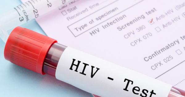 Трети човек с ХИВ е навлязъл в постоянна ремисия твърди