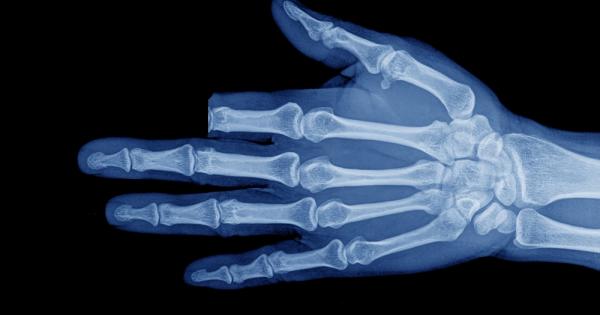 Докато един мъж сече дърва край своето село в планинския район