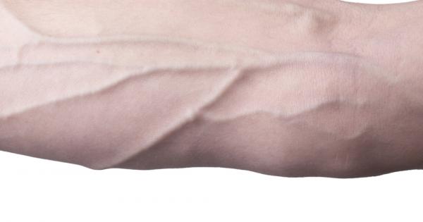 Всички знаем че кръвта ни е червена Всеки хирург ще ви