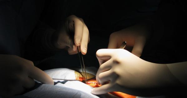 В болница в Тексас са направени 4 трансплантации на матки