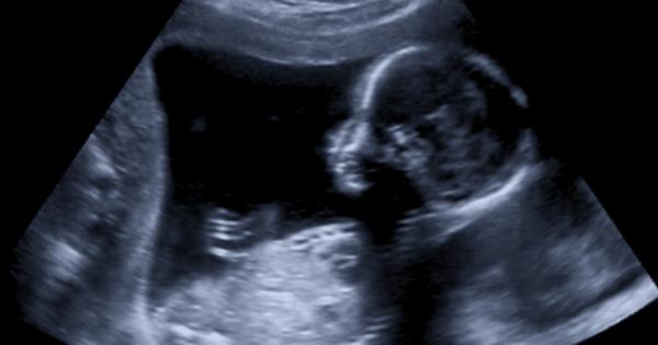 В рамките на един единствен месец 20 годишна жена от Бангладеш роди два