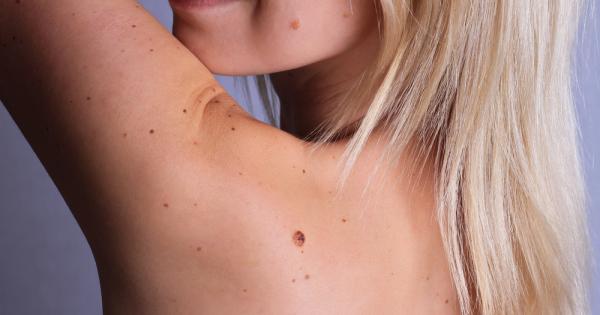 Лятото е в разгара си и слънцето изпълва дните ни