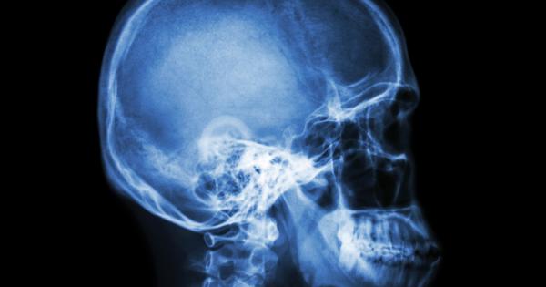 Американската компания Oxford Performance Materials базирана в град Саут Уиндзър