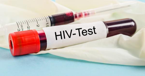 Миналата година свързаните с ХИВ смъртни случаи са паднали до