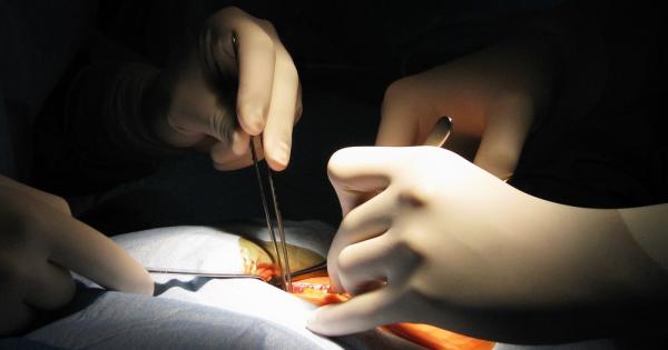 За пациентите това е било хазартно решение ако вземат участие