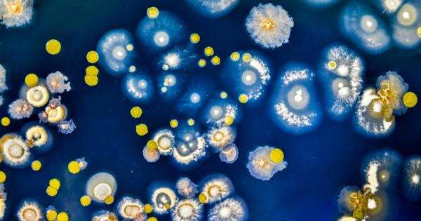 Не им е лесно на бактериите Не стига че имунните