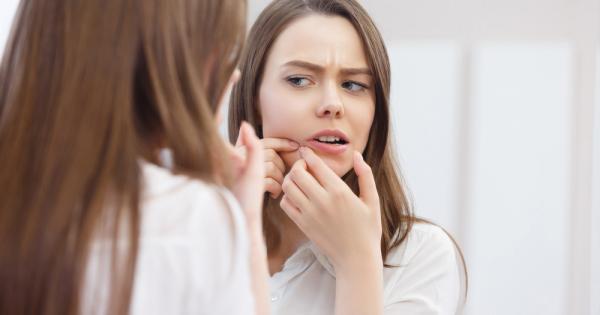 Ако страдате от акне вероятно вече знаете абсолютно всички популярни съвети за