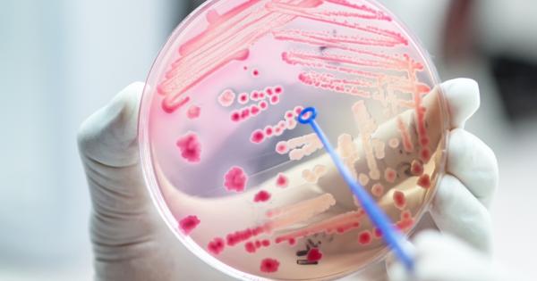 Ново изследване показва че в по голямата част на Европа резистентността