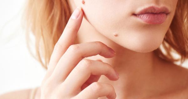 Ракът на кожата е най често срещаната форма на рак в