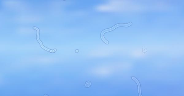 Виждате ли мушици пред очите си Спокойно не сте единствените